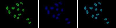 Immunocytochemistry/ Immunofluorescence: Histone H2A.Z [ac Lys7, ac Lys11, ac Lys4] Antibody [NBP3-18689]